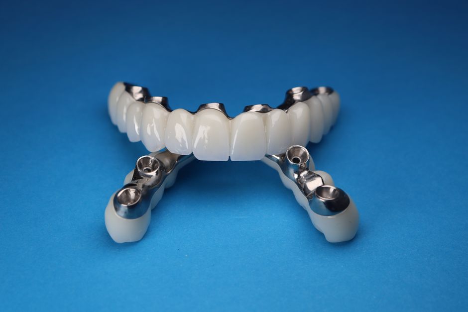 Modelo de arcada completa sobre implantes