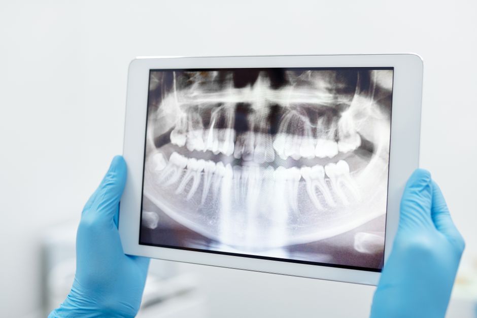 Radiografia panorâmica dos dentes e da mandíbula
